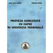 Proteza scheletata cu capse in edentatia terminala