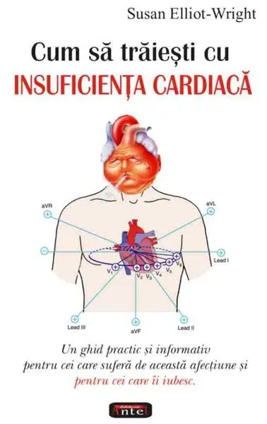 Cum să trăieşti cu insuficienţa cardiacă - Paperback brosat - Susan Elliot-Wright