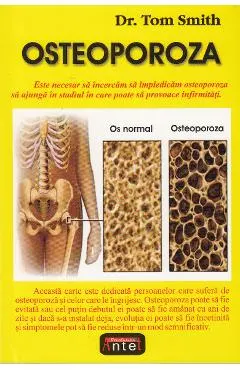 Osteoporoza