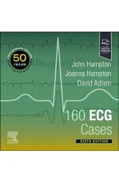 160 ECG Cases