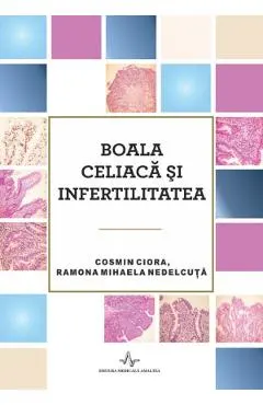 Boala celiaca si infertilitatea