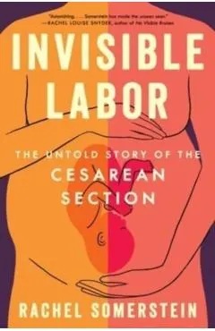 Invisible Labor: The Untold Story of the Cesarean Section