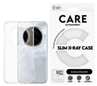 Husă CARE - Fashion, X-Ray, Honor 400 lite, transparent